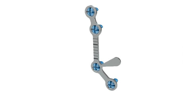 Arnett FAB orthognathic system