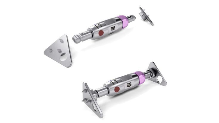 RPeX (Rapid Palatal Expander)